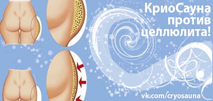 Акция на криосауну Алмаз 