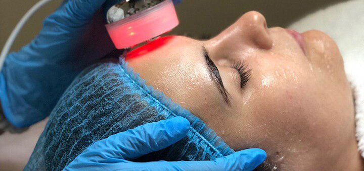 Up to 3 sessions of laser carbon facial peeling at the Face&Body center in Kyiv