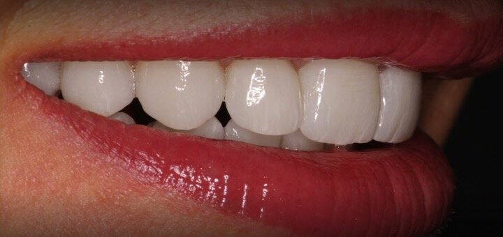 Promotions in the dental clinic &quot;smile factory in ivano-frankivsk&quot;