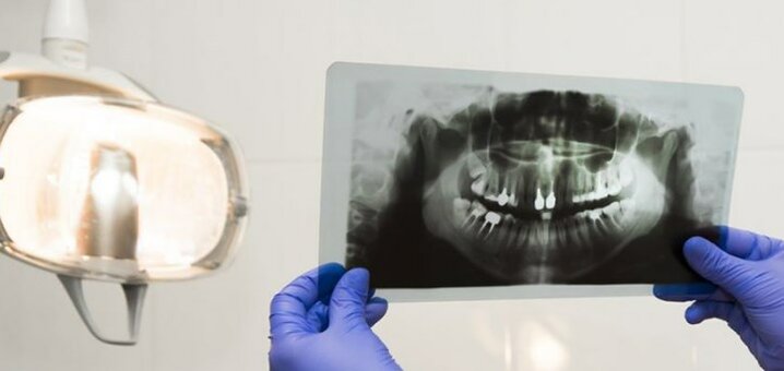 Promotions in the dental center ka-dent in kamyanets-podolsk