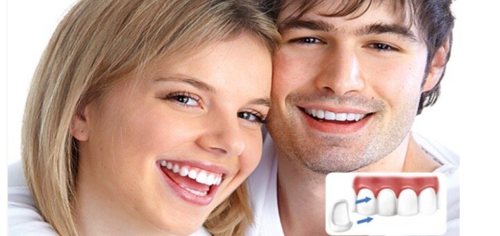 Акции в стоматологической клинике «Nazaria Dental»