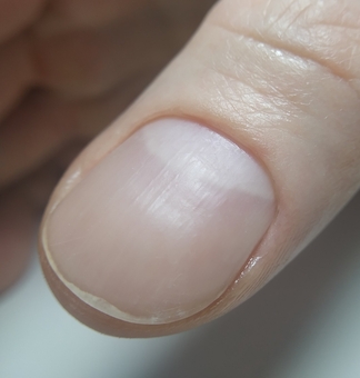 Discount medical pedicure