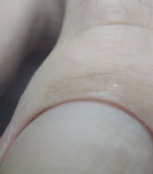 Discount medical pedicure