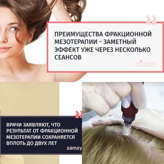 Mesotherapy of the scalp - when she and she alone helps