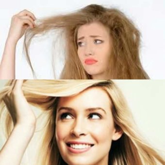 Scalp and hair restoration procedure from "Orising" (Italy) at an affordable price